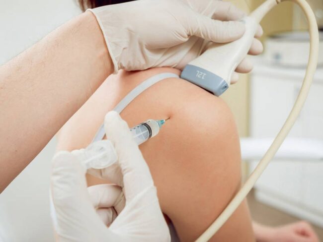 Điều trị cơ xương khớp công nghệ tế bào gốc Nhật Bản